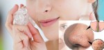 Bí quyết giúp se khít lỗ chân lông to hiệu quả tại nhà
