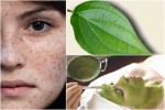 3 BÀI THUỐC TRỊ NÁM, TRỊ MỤN, BỆNH PHỤ KHOA CHỈ BẰNG LÁ TRẦU KHÔNG