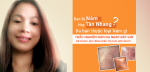 TRẮC NGHIỆM NÁM DA