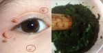 Giã nát loại rau này rồi đắp lên mặt, mụn thịt nhiều cỡ nào cũng biến mất chỉ sau 7 ngày sử dụng