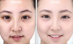 Tự làm serum vitamin C tại nhà giúp mờ thâm nám tàn nhang sáng da hiệu quả