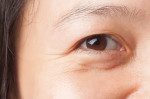 Lưu ngay 6 cách xóa nếp nhăn vùng mắt tại nhà bằng 100% tự nhiên